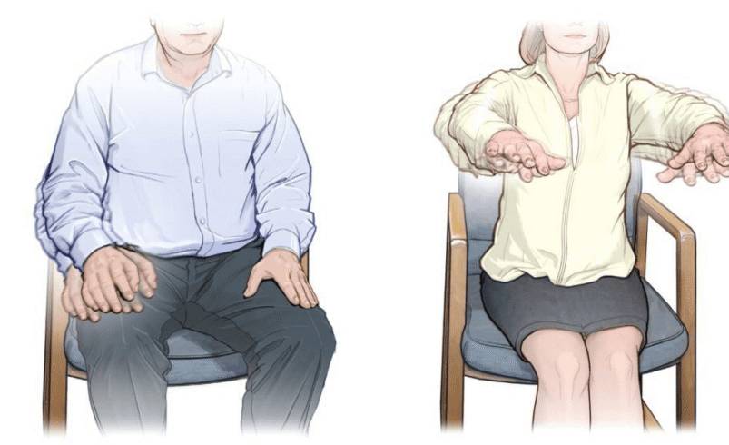 Parkinson’s Disease Physiotherapy in Edinburgh Today