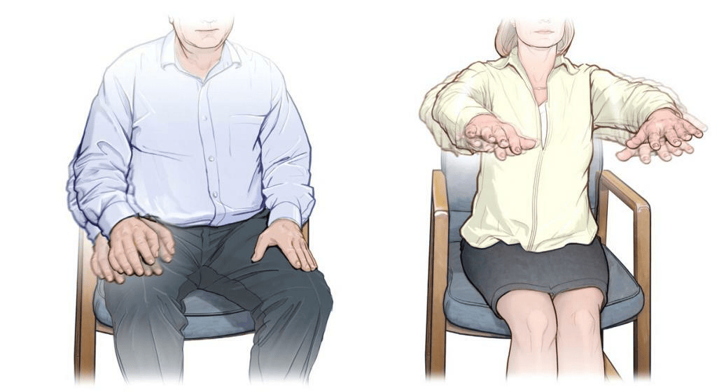 Parkinson’s Disease Physiotherapy in Edinburgh Today