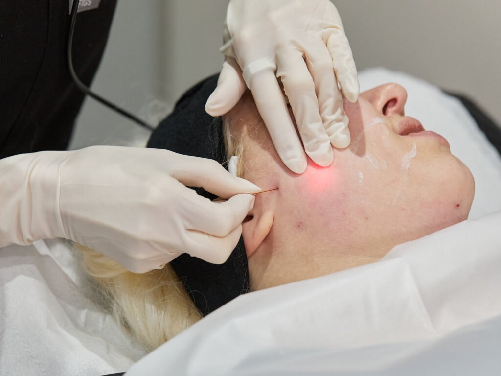 Endolift in London: How Is Facial Skin Structure Assessed During Consultation?