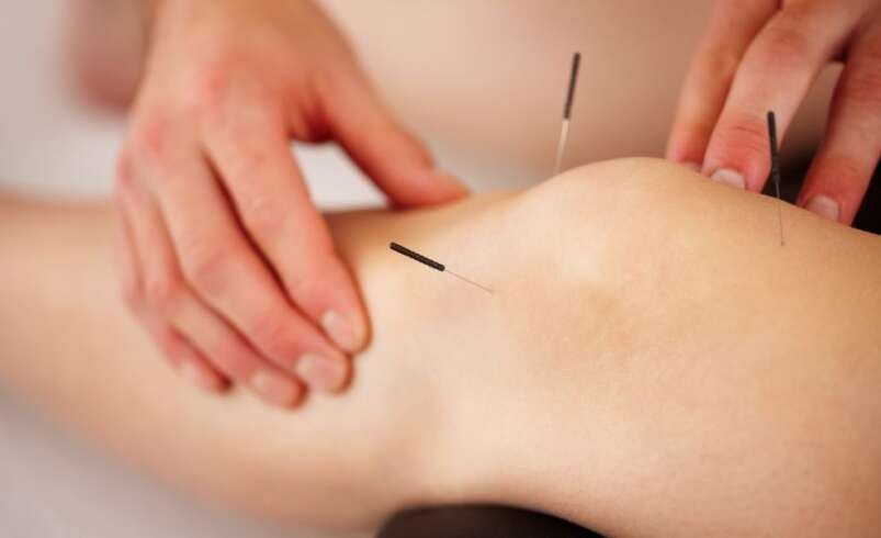 How Sciatica Acupuncture Works to Reduce Lower Back and Leg Pain