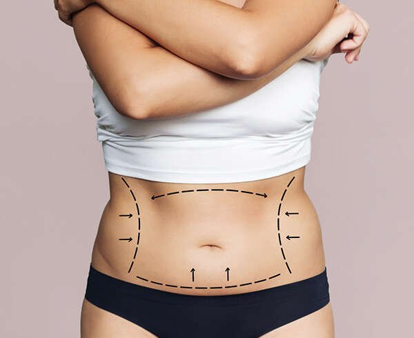 How Tummy Tuck in Dubai Fits Modern Cosmetic Surgery Goals