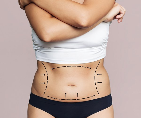 How Tummy Tuck in Dubai Fits Modern Cosmetic Surgery Goals