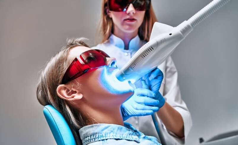 How Long Does In-Chair Teeth Whitening Last?