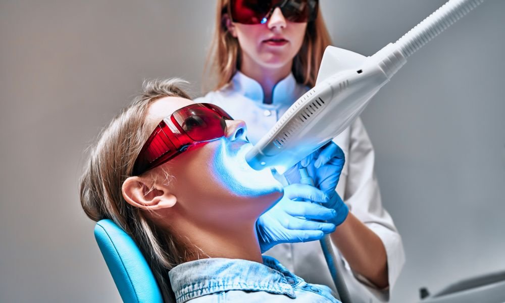 How Long Does In-Chair Teeth Whitening Last?