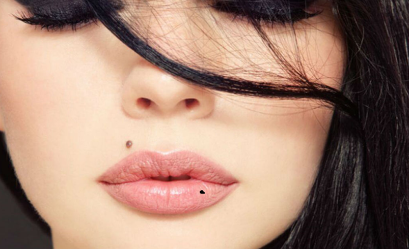 Lip Mole Removal: A Complete Guide to Safe and Effective Treatment