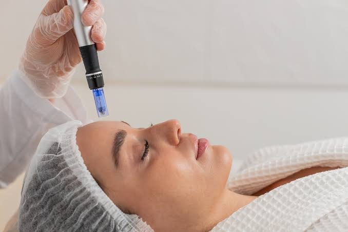 Best Dermapen Microneedling in Dubai: Exploring Care for Uneven Skin Texture