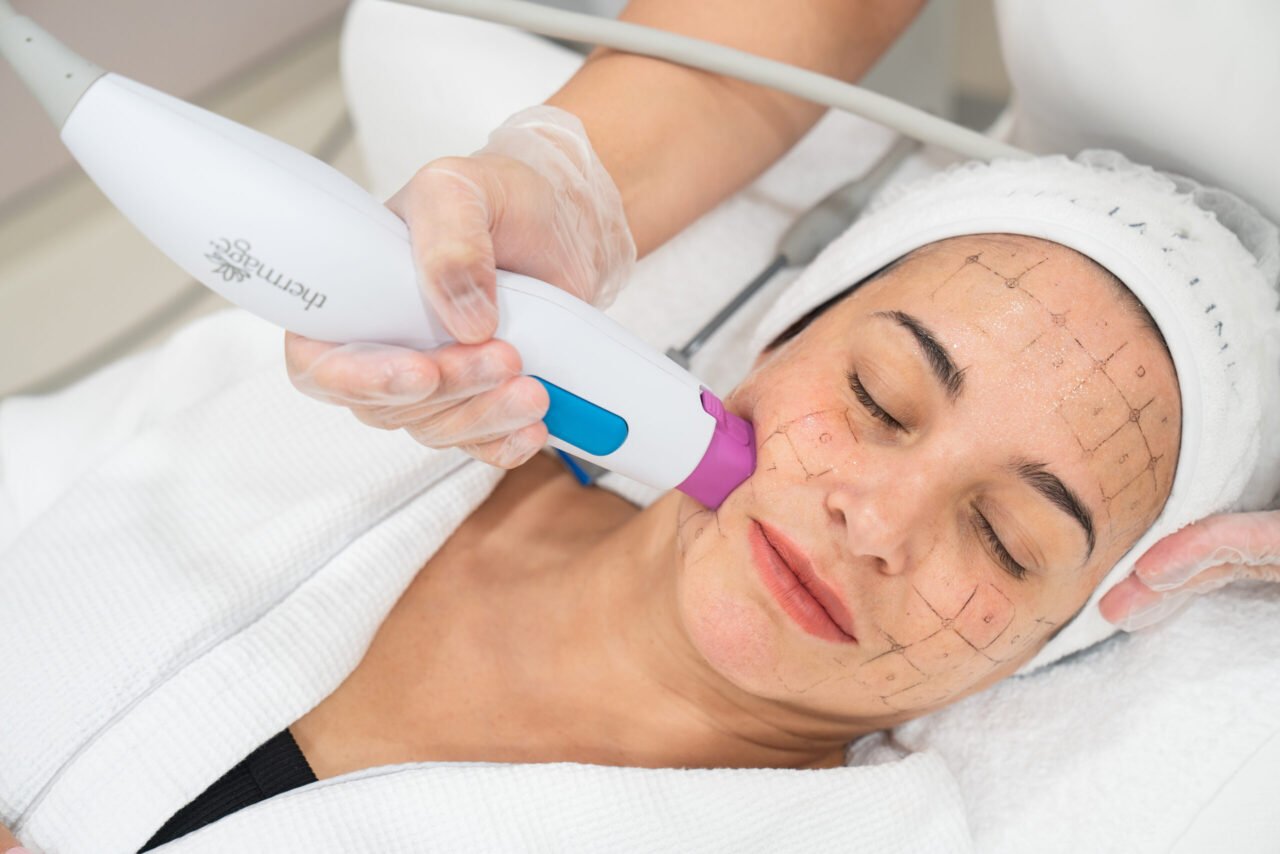 How Facial Contours Influence Thermage Skin Tightening in Dubai